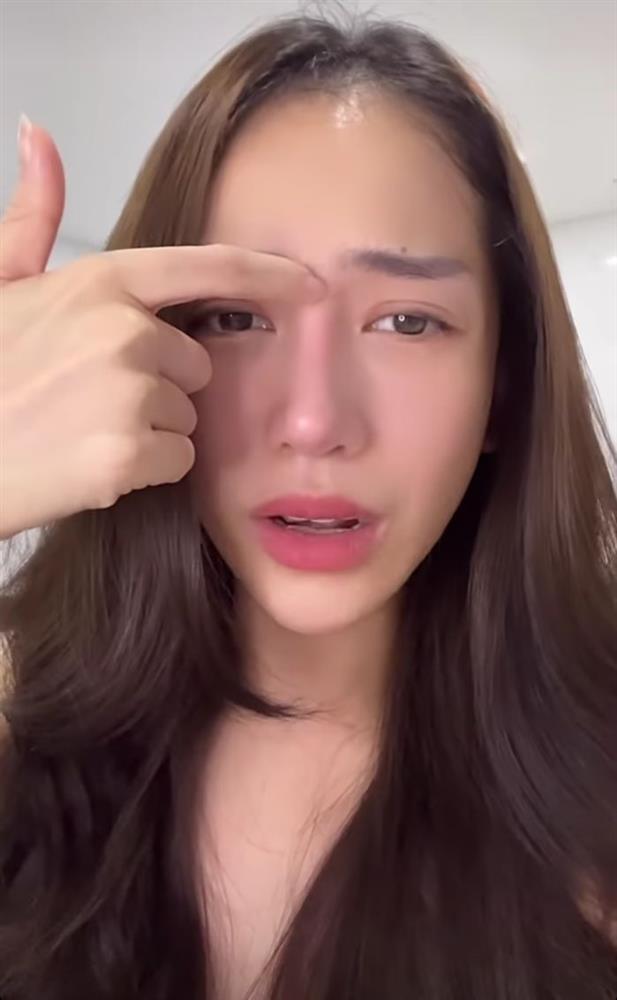 Bị nói thẩm mỹ hỏng mũi mọc từ trán, con Minh Nhựa đáp căng-4