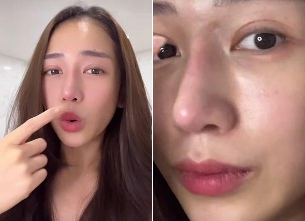 Bị nói thẩm mỹ hỏng mũi mọc từ trán, con Minh Nhựa đáp căng-5