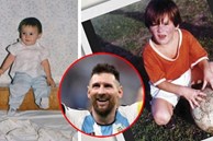 Điều ít biết về căn bệnh hiếm Lionel Messi mắc khi còn nhỏ khiến anh suýt từ giã sự nghiệp