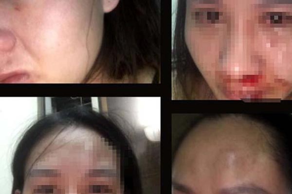 Rừng cây bạc trắng băng tuyết ở Nghệ An-7