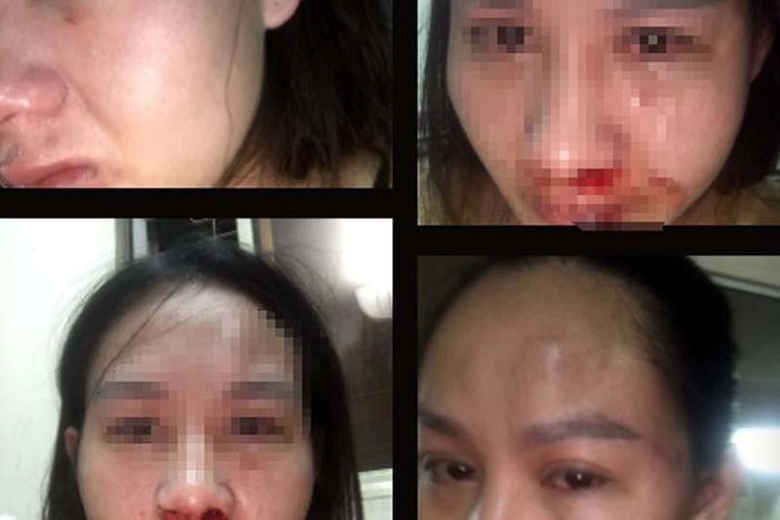 Hà Nội: Một cán bộ công an bị tố đánh vợ con bầm dập-2