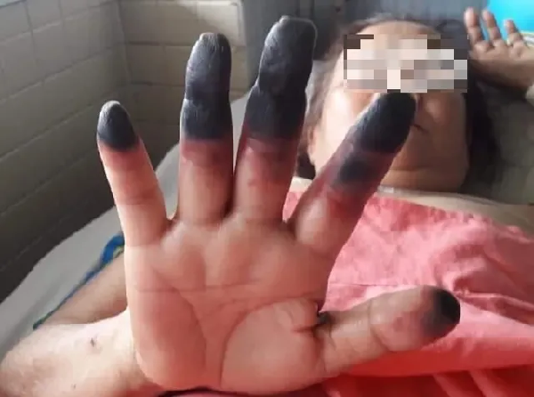 Đau nhức chân tay coi chừng bệnh lý nguy hiểm-2