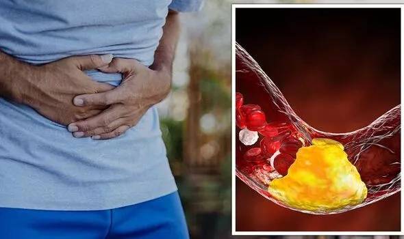 Đây là yếu tố có thể khiến các khối u ung thư ruột hình thành nhanh hơn 100 lần-1