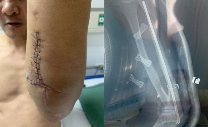 Đi tìm người nhắn tin gạ tình vợ, chồng bị chém trọng thương-1