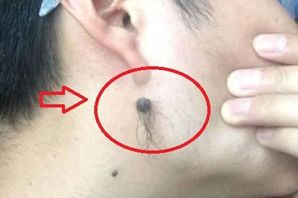 Thầy tướng số nói: Người có lông mọc nhiều ở 4 vị trí này rất giàu, tài lộc đến không cản được-1