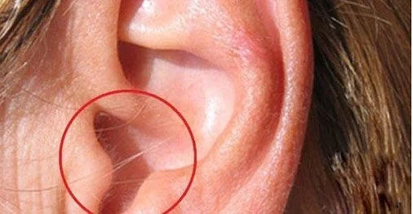 Thầy tướng số nói: Người có lông mọc nhiều ở 4 vị trí này rất giàu, tài lộc đến không cản được-2