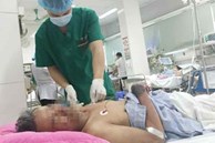 Người đàn ông bán thịt ở Hà Nội nguy kịch vì nhiễm liên cầu khuẩn lợn
