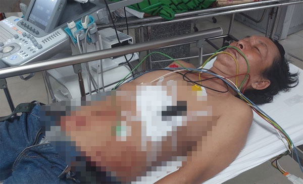 Người đàn ông bị truy tìm nằm bất động, dao cắm vào ngực-1