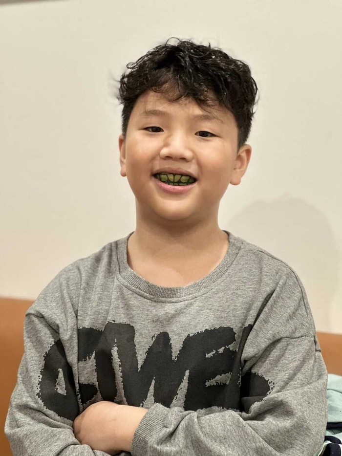 Con trai Thu Quỳnh được mẹ cho chỉnh nha từ lúc 7 tuổi: Đâu là độ tuổi tốt nhất để chỉnh nha cho bé?-5