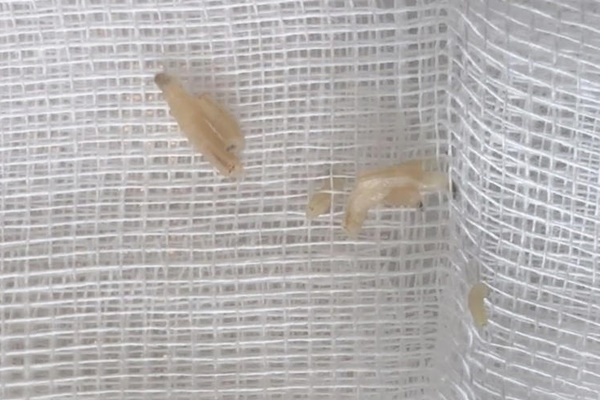 Đau tai dữ dội và chảy máu, người đàn ông kinh hoàng phát hiện cả tổ ký sinh trùng đang ăn mòn màng nhĩ bên trong-2