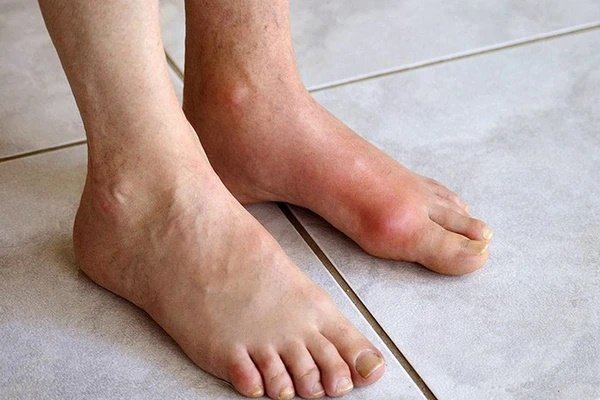 7 nguy hại đối với sức khỏe khi Tết ăn nhiều bánh kẹo, nước ngọt-3