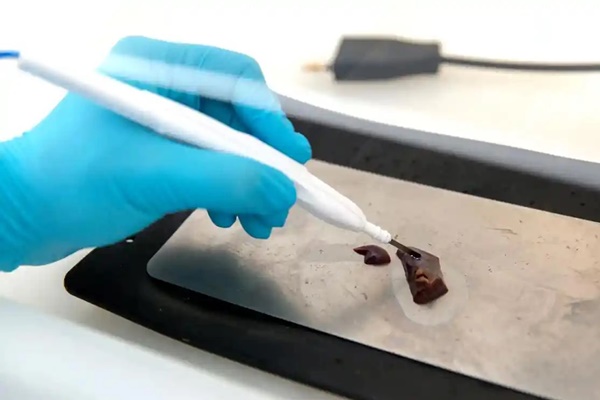 Những quan niệm sai lầm thường gặp về bệnh ung thư-2