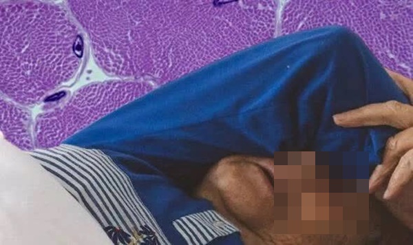 Thiếu một loại vitamin, người phụ nữ nằm liệt giường: Cẩn trọng với 2 triệu chứng cảnh báo-1