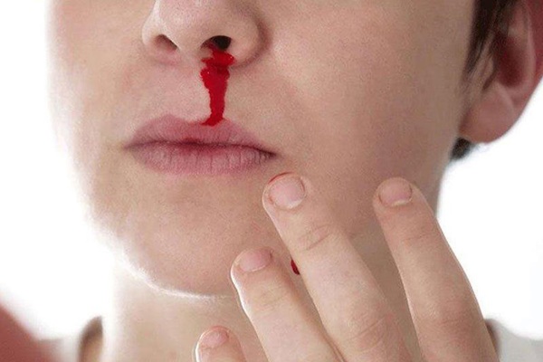 Nghẹt mũi, đau đầu kéo dài có thể là dấu hiệu bạn đã có khối u trong mũi-1