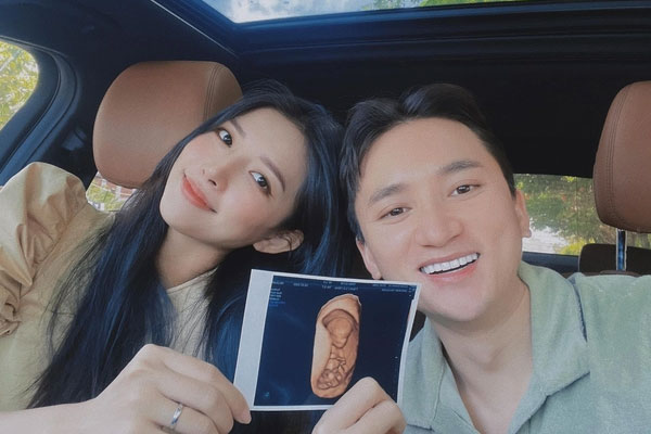 Vợ Phan Mạnh Quỳnh: Em bé ra đời khóc không to bằng ông bố-5