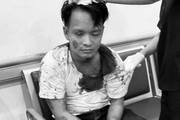 Bắt đối tượng đâm chết một cảnh sát hình sự sau vụ va quệt xe-1