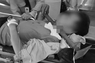 Tây Ninh: Ngã giàn giáo, nam công nhân bị thanh sắt đâm xuyên cổ nguy kịch