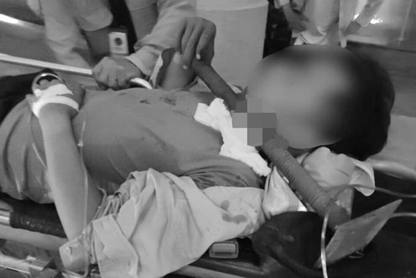 Tây Ninh: Ngã giàn giáo, nam công nhân bị thanh sắt đâm xuyên cổ nguy kịch-1