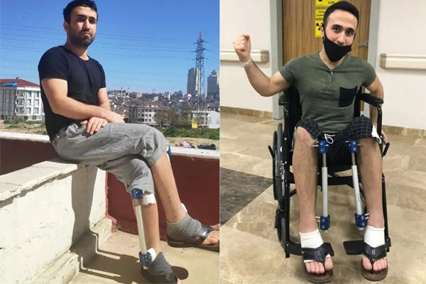 Đổi đời khi kéo dài chân 13 cm-1