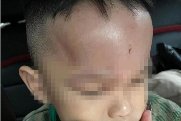 Bé trai 2 tuổi chết bất thường trong trường mầm non ở Nha Trang-2