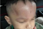 Bé trai 2 tuổi chết bất thường trong trường mầm non ở Nha Trang-2