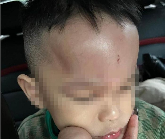 Đà Nẵng: Xác minh thông tin trẻ bị bạo hành ở trường mầm non-1