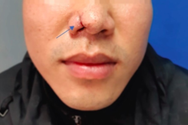 4 loại thực phẩm bác sĩ ung bướu không bao giờ ăn nhưng nhiều người thích-3