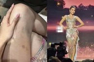 Ngọc Châu gây xót xa với đôi chân bầm dập, khóc đến đỏ mắt hậu out top tại Miss Universe 2022