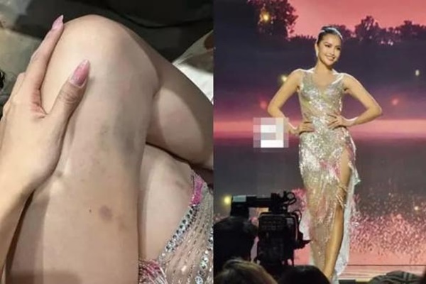 Ngọc Châu gây xót xa với đôi chân bầm dập, khóc đến đỏ mắt hậu out top tại Miss Universe 2022-1
