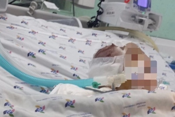 Vụ bé 6 tháng tuổi bị đánh dập não: Nạn nhân thương tích 99%-1