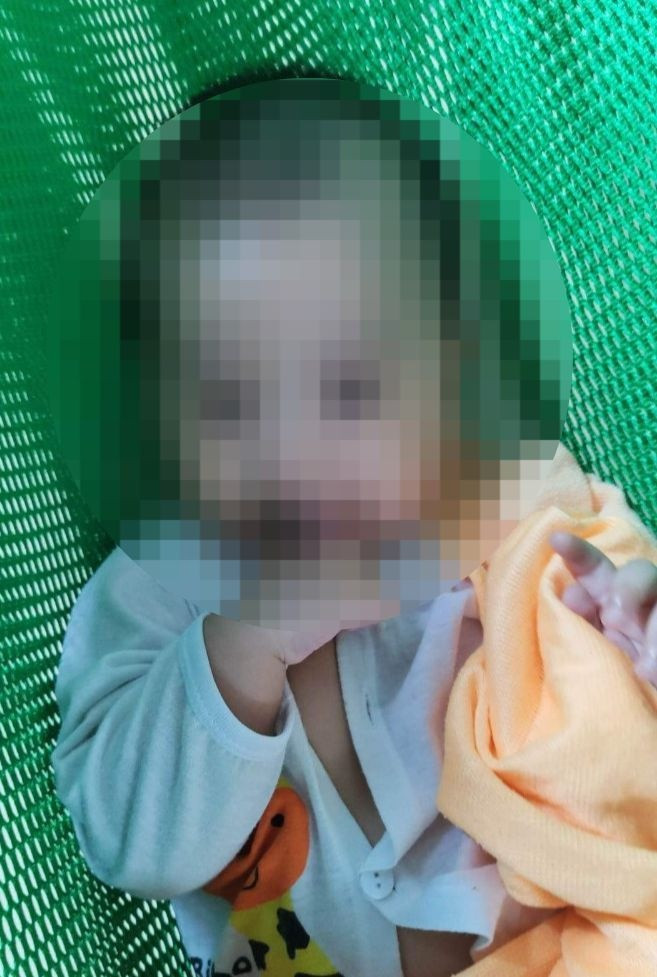 Bé 6 tháng tuổi nghi bị bảo mẫu bạo hành vẫn hôn mê sâu, nguy kịch-1