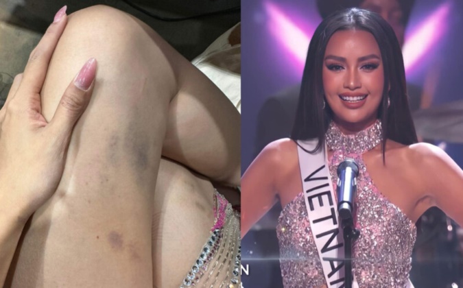 Xót xa cho Ngọc Châu: Viết tâm thư xin lỗi khán giả vì trượt Top 16, lộ đôi chân bầm tím và hình ảnh khóc nức nở sau hậu trường-4