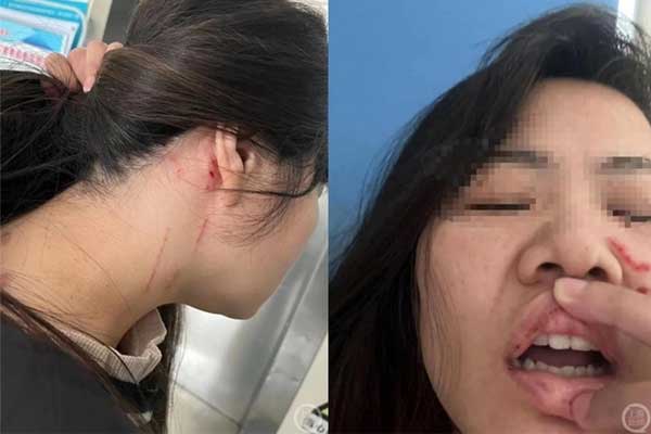 Phẫn nộ cô gái bị đánh nhập viện vì từ chối đi xem mắt-2