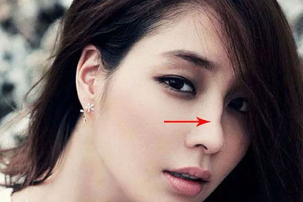 Người phúc mỏng, phận bạc càng già càng nghèo khổ trên mặt có 4 thứ này: Ai không có thật đáng chúc mừng-2