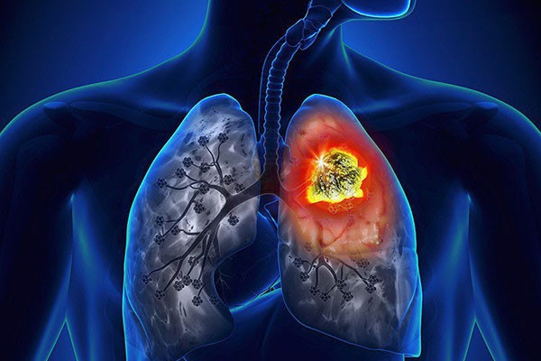 Tia cực tím từ máy sấy móng tay có thể làm hỏng DNA, gây đột biến tế bào tăng nguy cơ ung thư-4