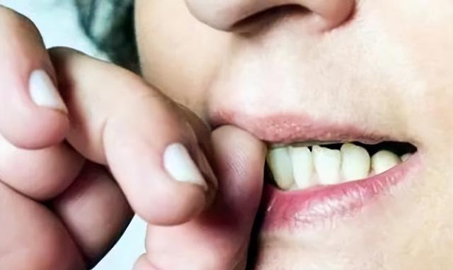 Điều gì sẽ xảy ra với một đứa trẻ hay cắn móng tay khi lớn lên? Bác sĩ chỉ ra 4 tình huống hay xuất hiện-3