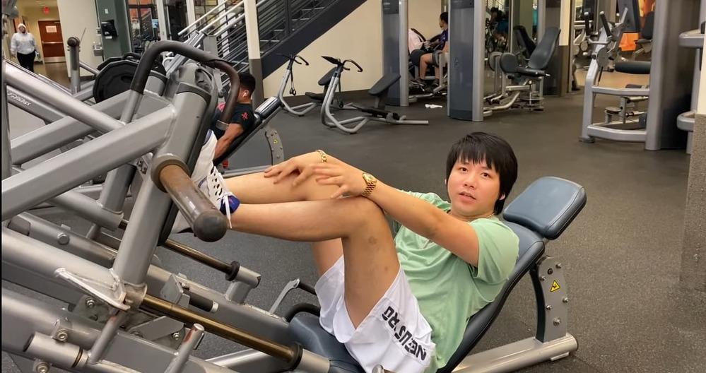 Giật mình đôi chân đầy sẹo Khoa Pug khi chi 5 tỷ tăng chiều cao-4