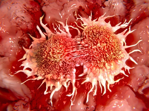 3 thói quen có thể giúp bạn miễn dịch với ung thư-1