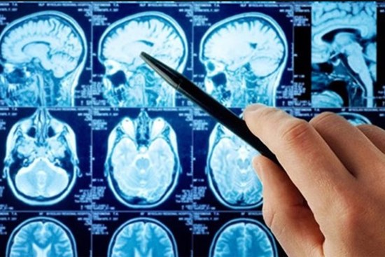 Người đàn ông 35 tuổi đột quỵ giữa đêm