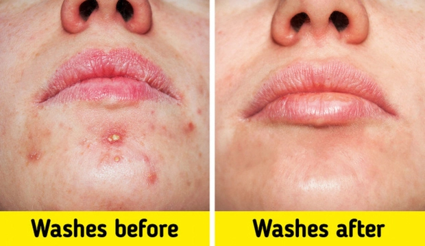 Lý do không nên rửa mặt dưới vòi hoa sen-2