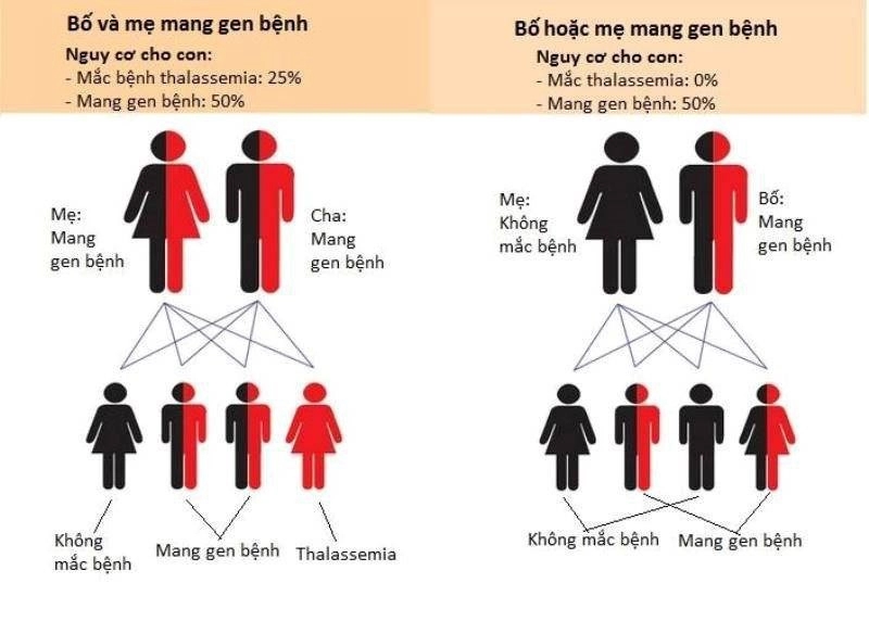 Thalassemia - căn bệnh khiến trẻ thiếu máu nhưng thừa sắt bẩm sinh-2
