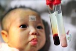 Thalassemia - căn bệnh khiến trẻ thiếu máu nhưng thừa sắt bẩm sinh