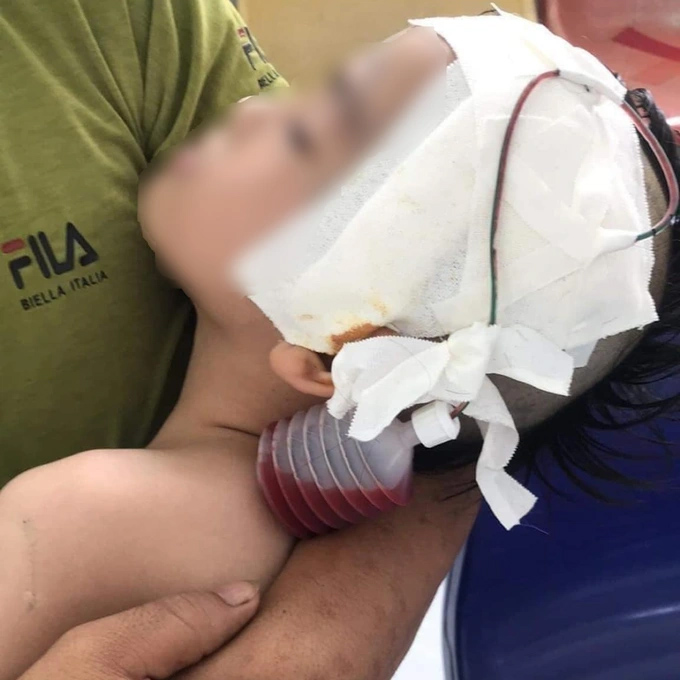 Làm giả chứng nhận cháu bé chấn thương sọ não để quyên tiền từ thiện-2