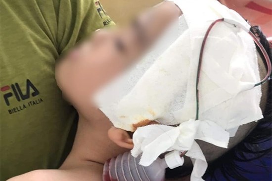Làm giả chứng nhận cháu bé chấn thương sọ não để quyên tiền từ thiện