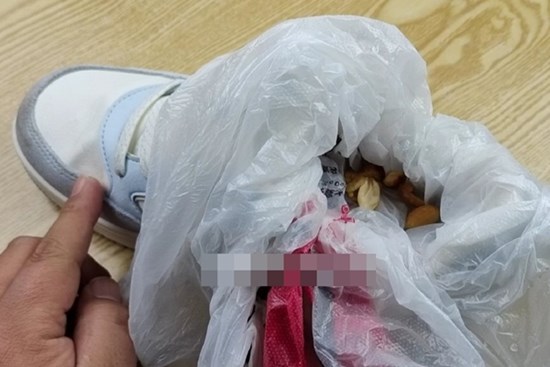 Giày đi bị kích chân gây phồng rộp? Mách bạn mẹo nới lỏng chỉ từ một nắm đậu phộng