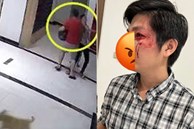 Chủ chó lên tiếng vụ người đàn ông bị đánh chảy máu mặt vì chú chó ở chung cư