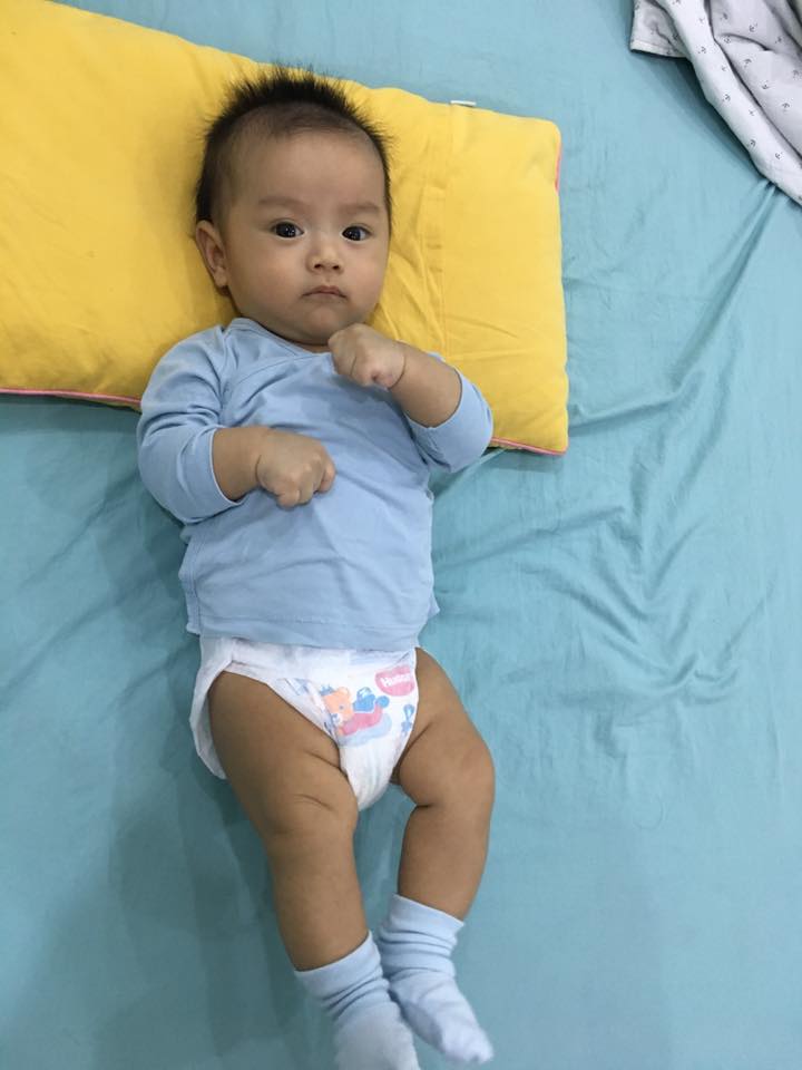 Mẹ sử dụng bỉm quần sớm cho trẻ có thể khiến con bị ảnh hưởng khớp háng?-3