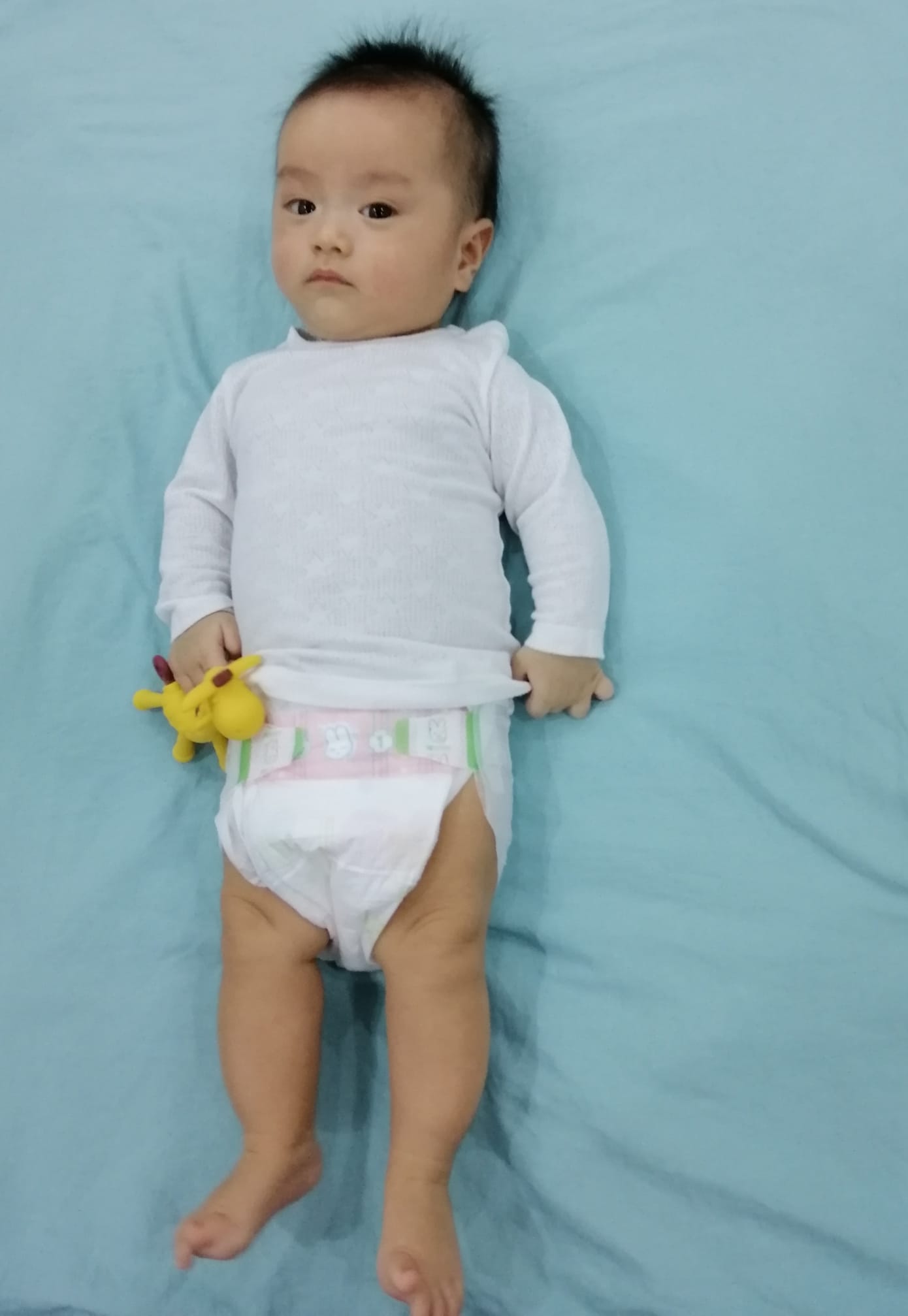 Mẹ sử dụng bỉm quần sớm cho trẻ có thể khiến con bị ảnh hưởng khớp háng?-2