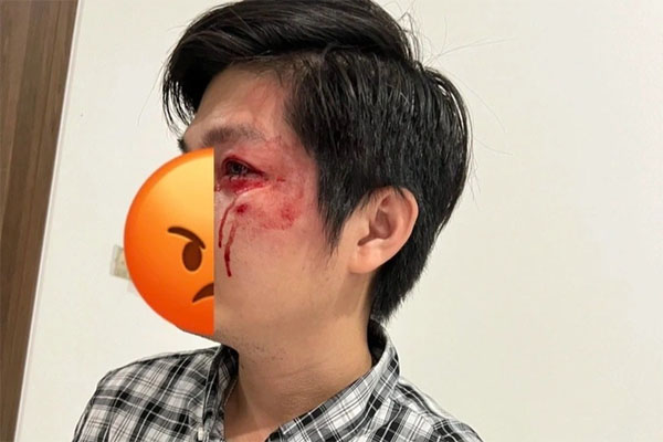 Chủ chó hành hung người cha bảo vệ con có thể đối diện 2 hình phạt-3