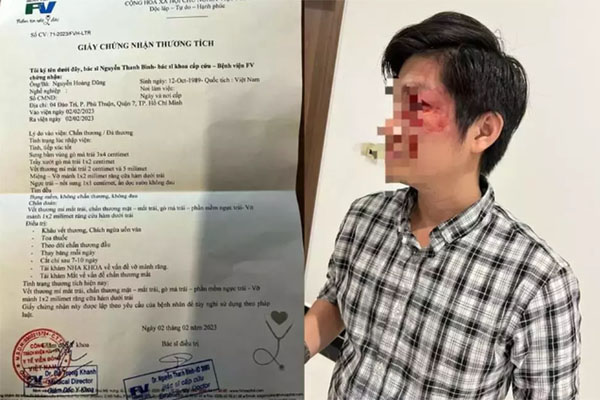 Khu chuồng bò cũ nhiều điểm nghi vấn vạch trần tội ác của gã đàn ông với nhân tình-2